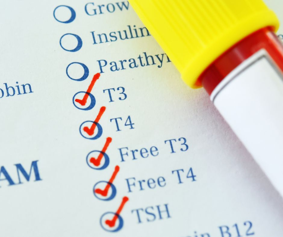 Hyperthyroid Numbers What Do All of These Thyroid Numbers Mean? And…What Can I Do About It ...