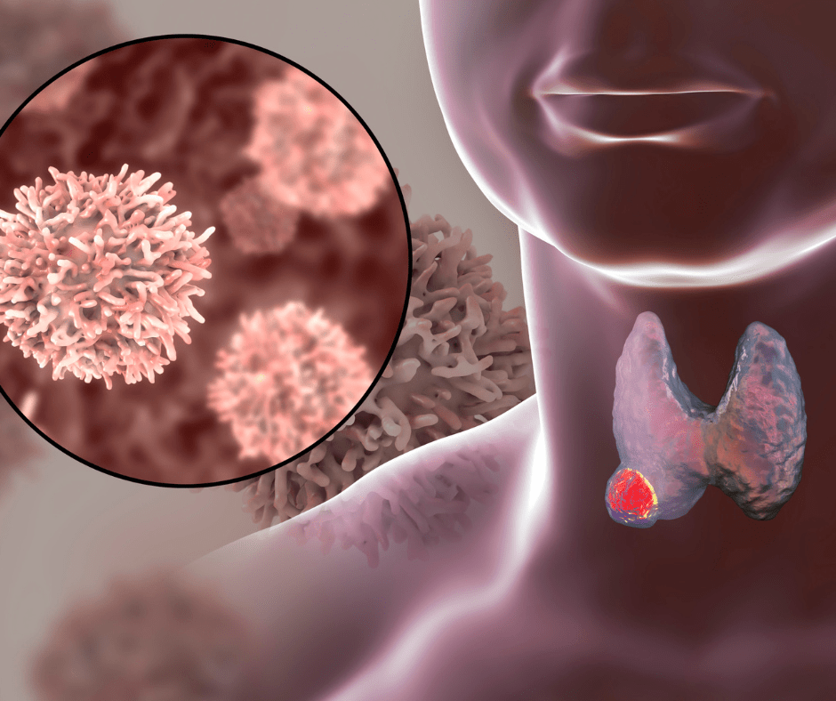 What Non-Sweet Foods Affect Blood Sugar and Thyroid&nbsp;Health?