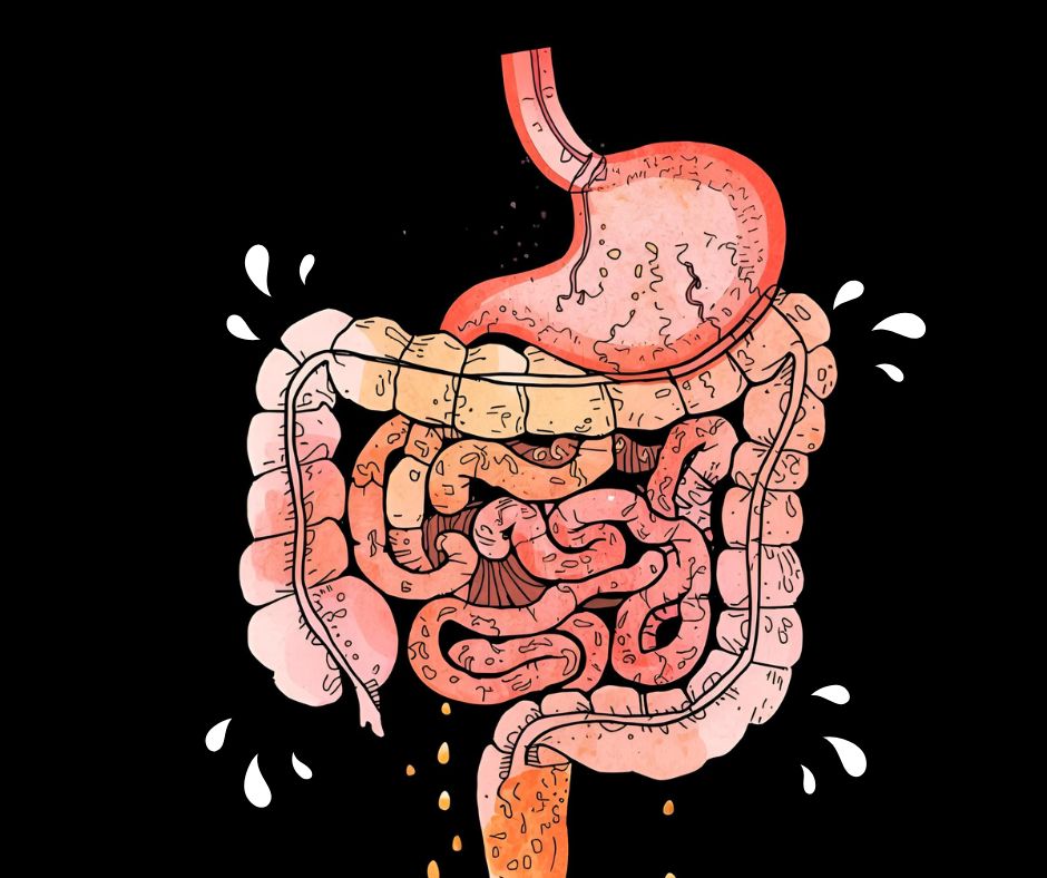 How to Heal a Leaky Gut: My Journey With Zonulin, Autoimmunity, and Gut&nbsp;Repair